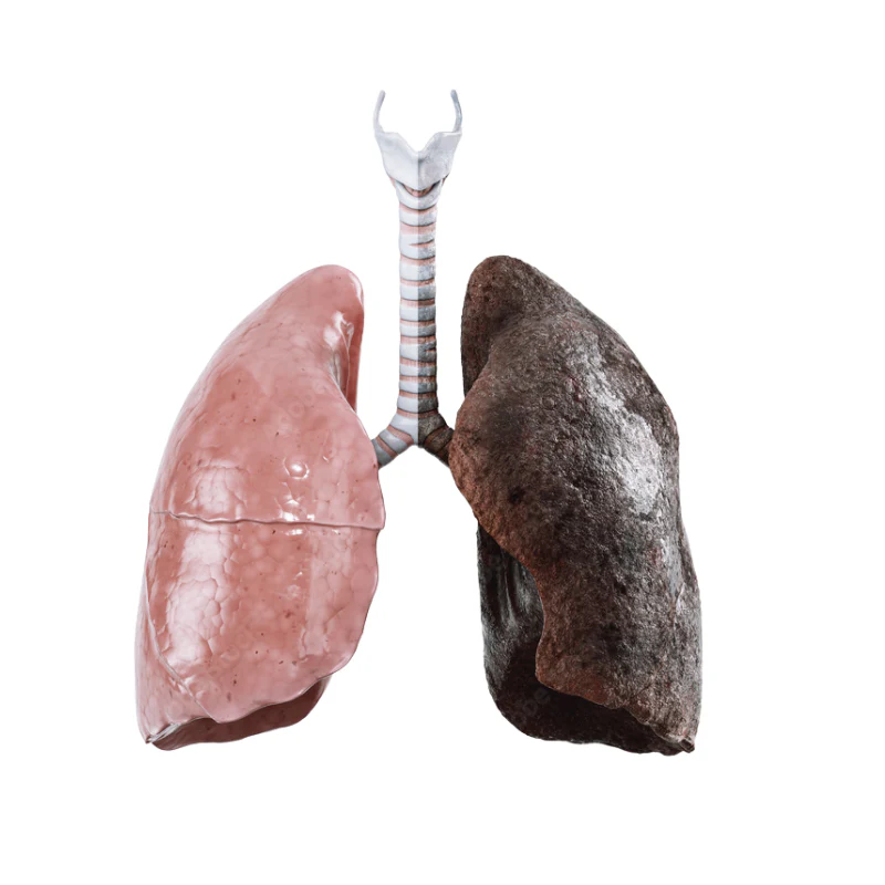 Clear Your Lungs Naturally